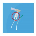 จำหน่ายราคาส่งกระเปาะพ่นยา (Nebulizer Jar) - บริษัท แอสเซ้นท์ เมดิคอล จำกัด