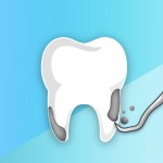 การขูดหินปูน - คลินิกทันตกรรมเด็นทัลวิลลา