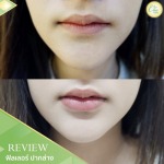 Chic Clinic Co., Ltd.