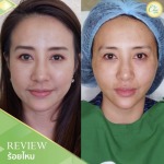 Chic Clinic Co., Ltd.