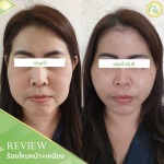 Chic Clinic Co., Ltd.